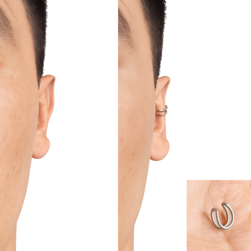 🔥 Increíble Corrector de Orejas Piercing Estético y Discreto (2 Unidades)