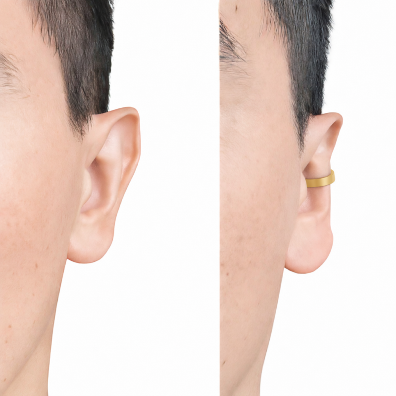 Corrector de orejas Clipping, elige tu color.