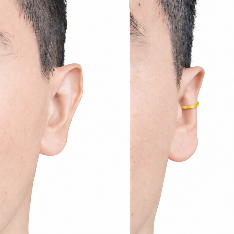 Corrector de Orejas Colores Clipping ( 2 unidades )