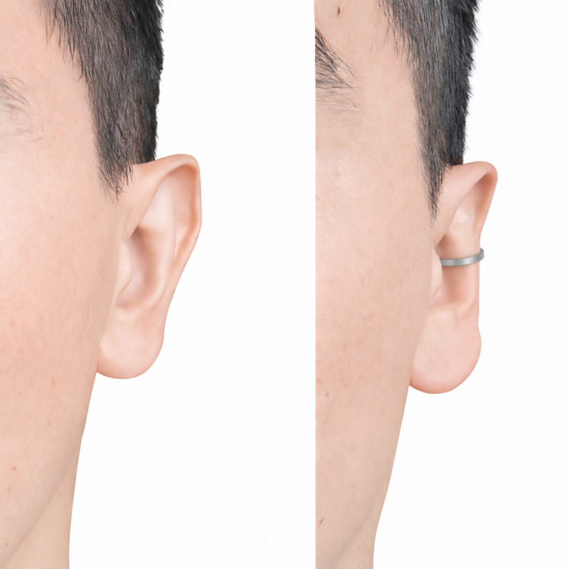 Corrector de orejas gris promo ( 4 unidades)