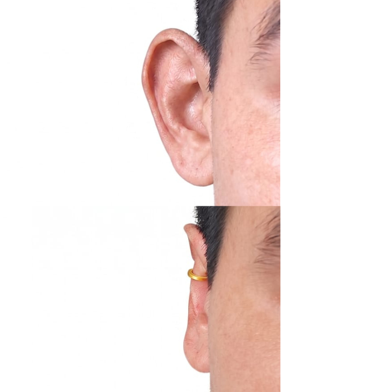Antes y después cliente Clipping