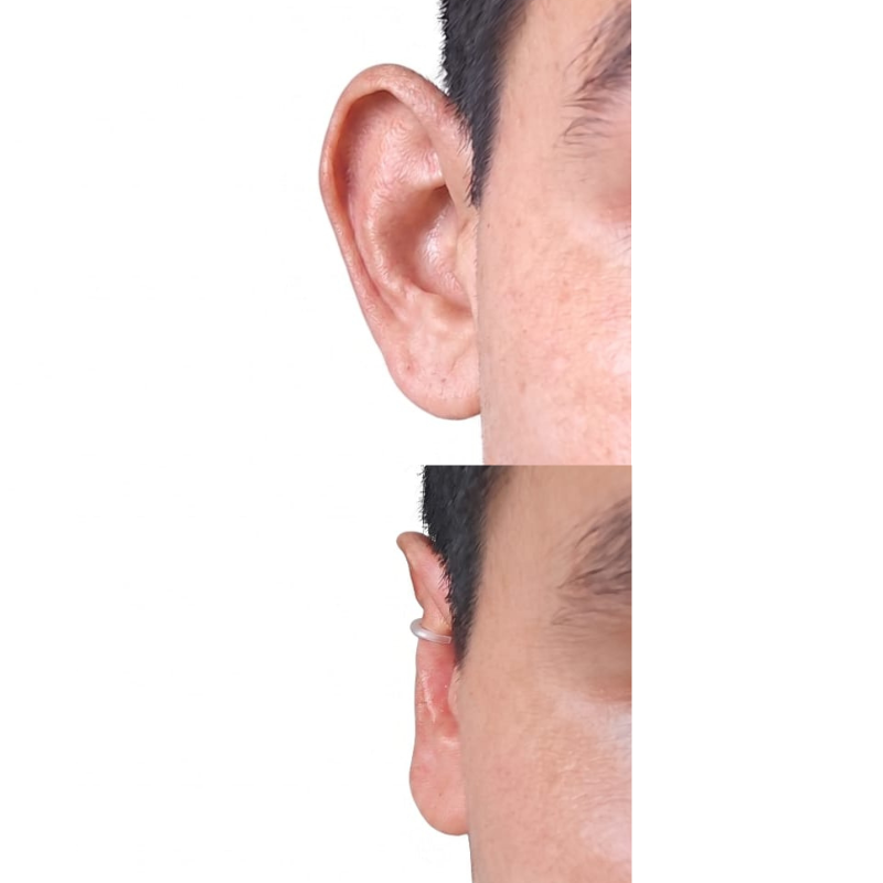Antes y después cliente Clipping