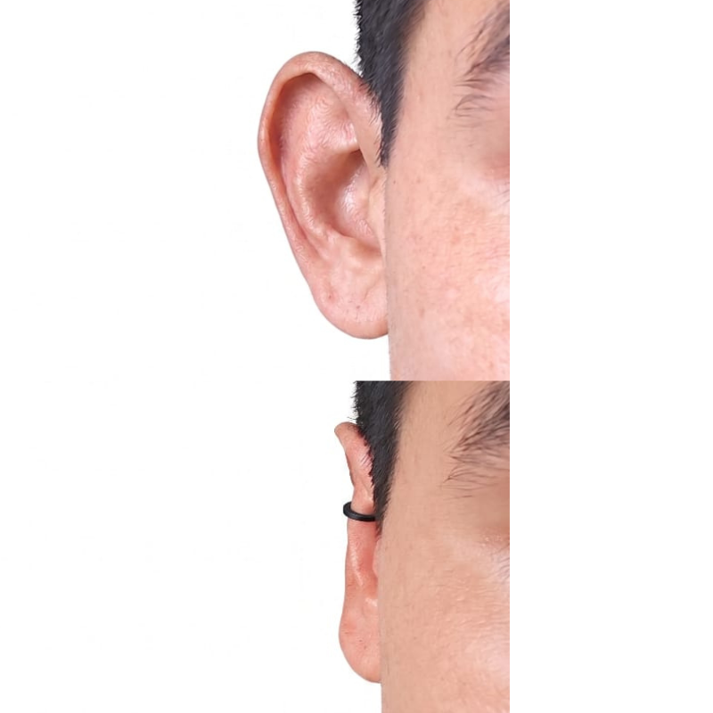Antes y después cliente Clipping