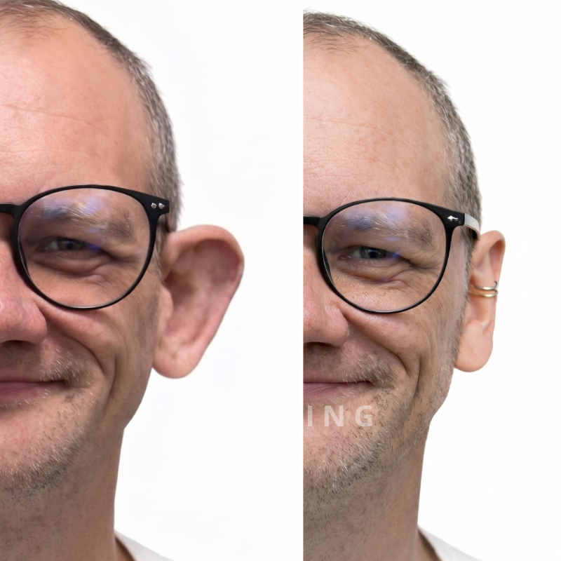 Antes y después método Clipping